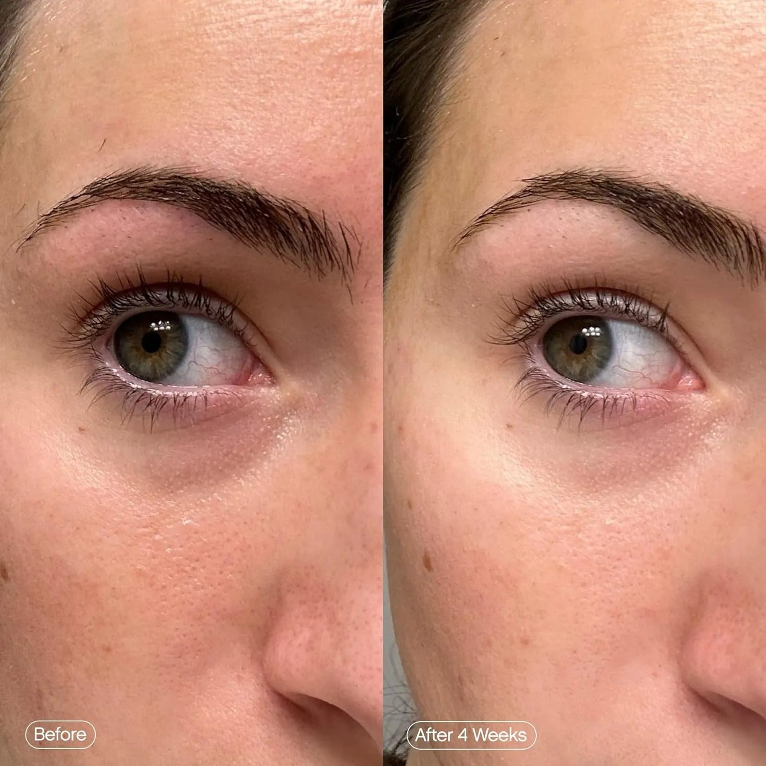 image comparison before